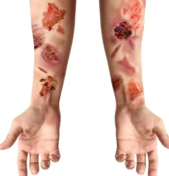 Sår og Ar tattoo - flesh wound